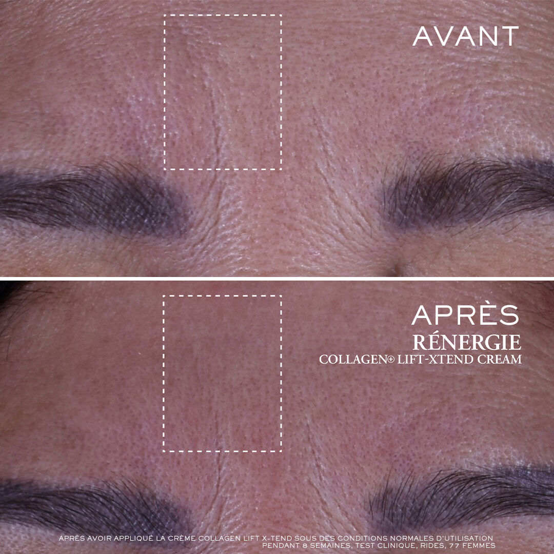 Creme Renergie Collagen+ Lift-Xtend
