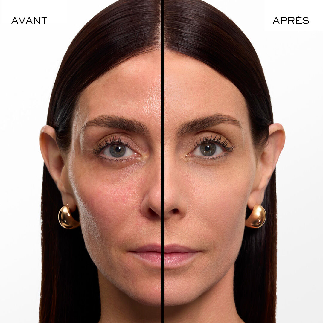 Visuel avant et apres