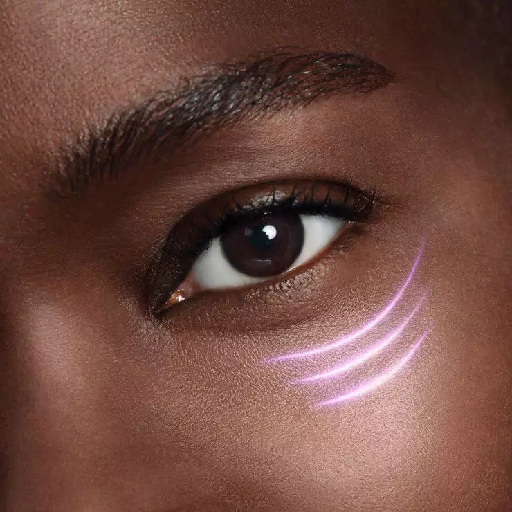 Un gros plan sur l'oeil d'une personne, mettant en valeur des marques violettes elegantes sur sa joue.