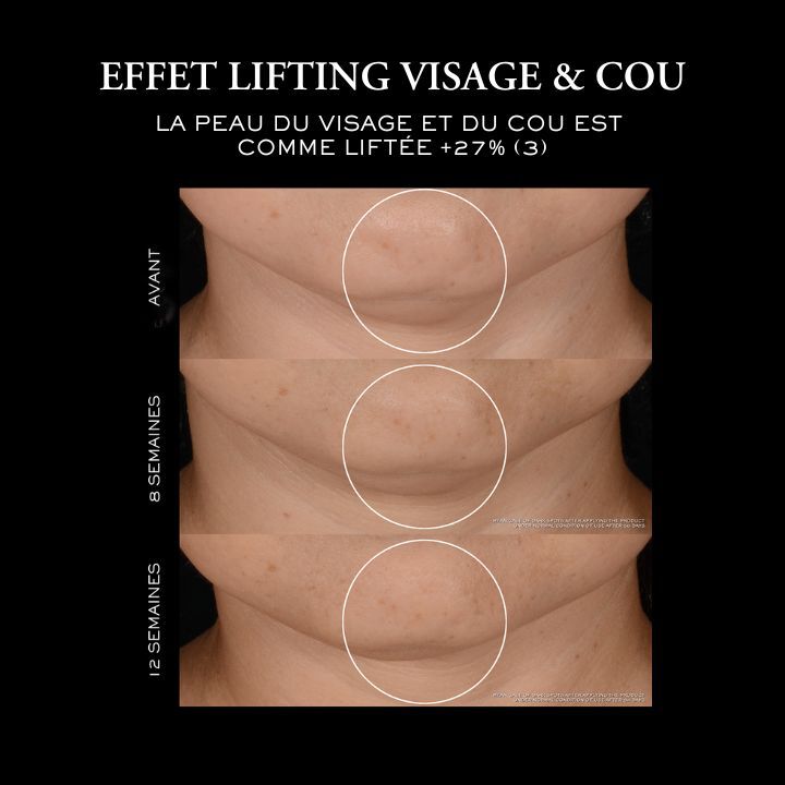 Effet liftint