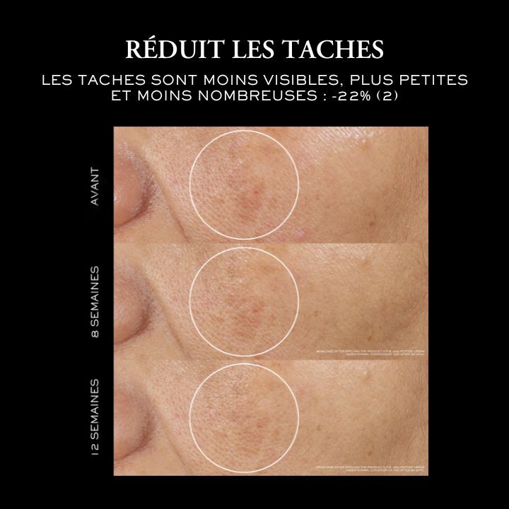 Reduit les taches
